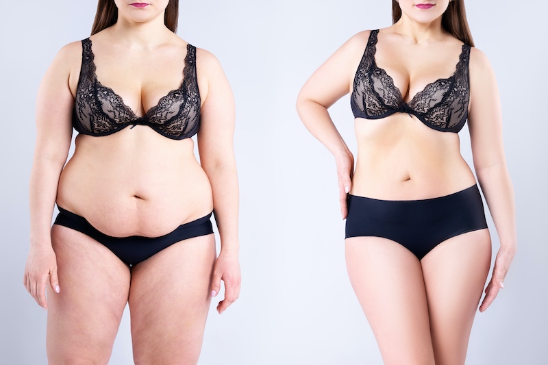 weight-loss before and after