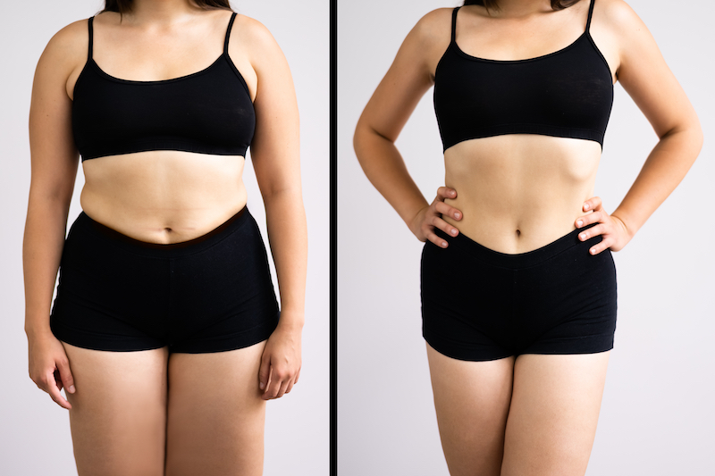 weight-loss before and after
