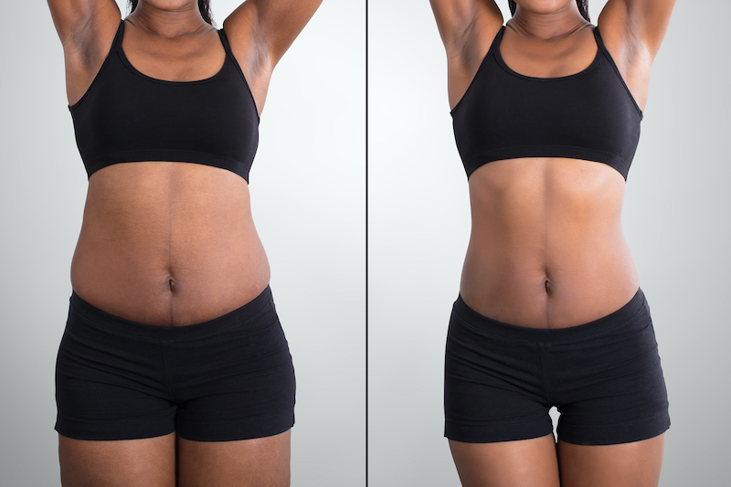 weight-loss before and after